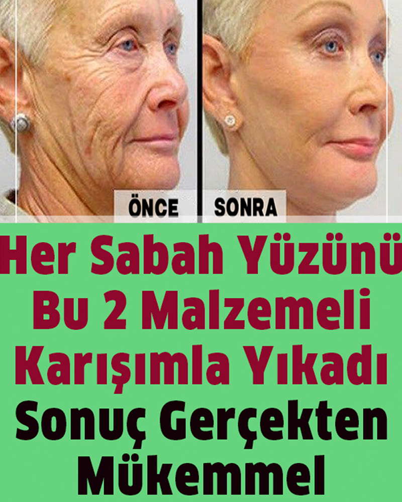 Her Sabah Yüzünüzü Bu 2 Malzemeli Karışımla Yıkayın