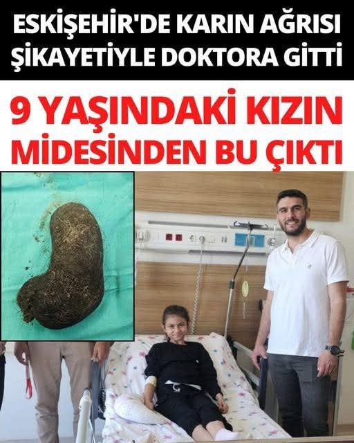 Eskişehir’de küçük kızın midesinden bakın ne çıktı