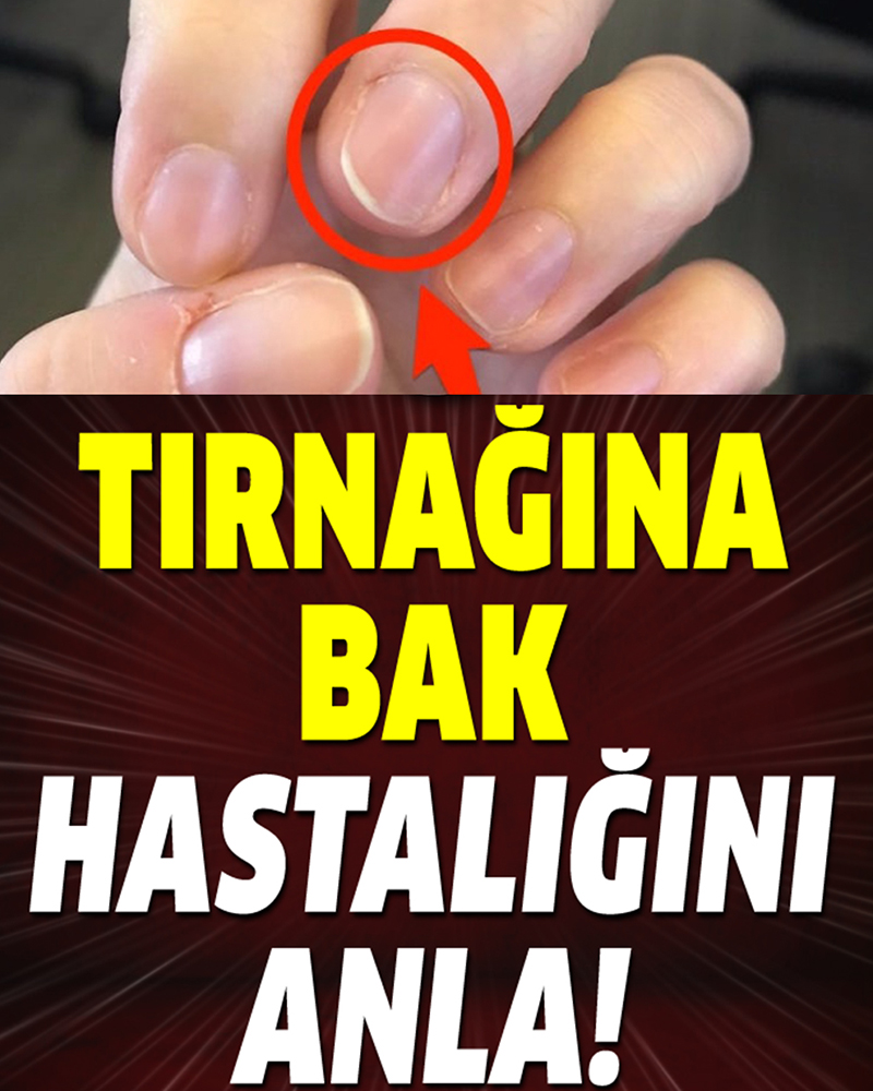 Tırnağına bak hastalığı anla