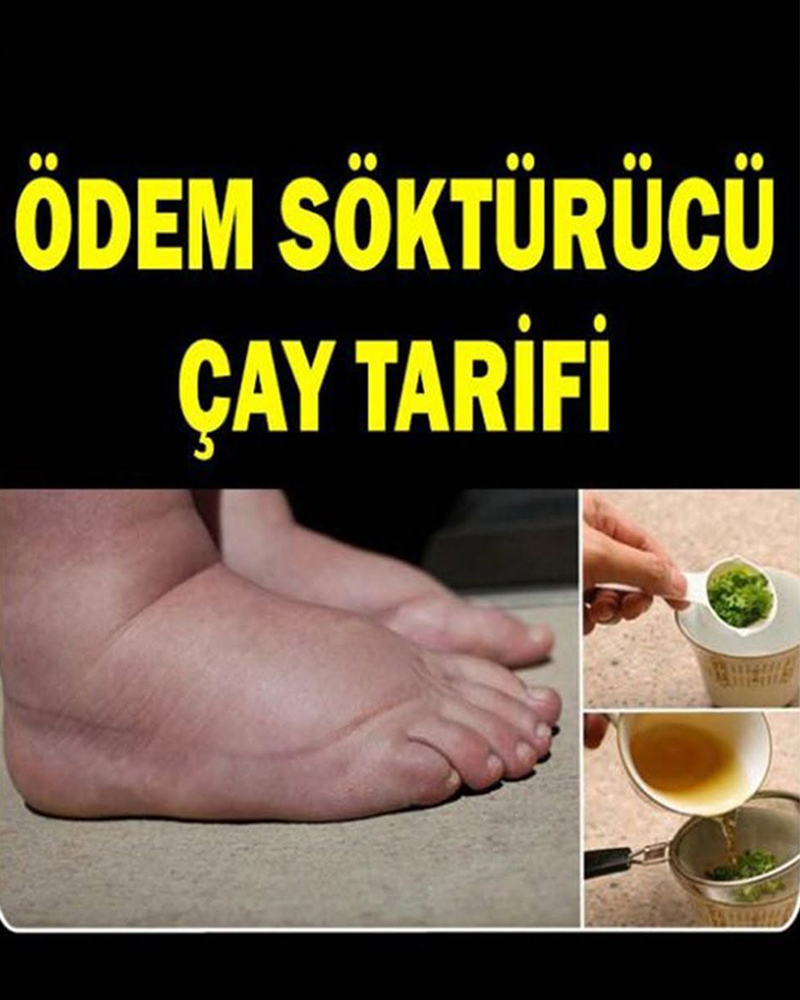 Ödem Söktürücü Çay Tarifi