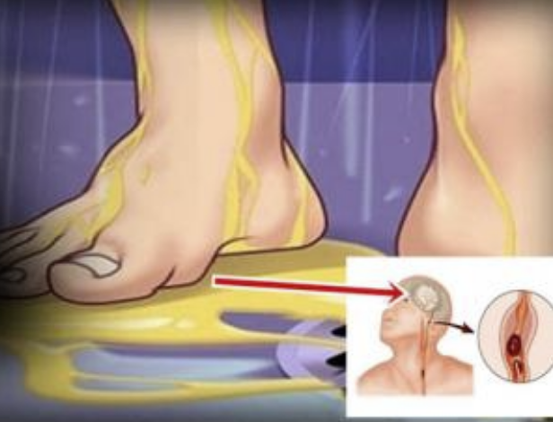 Dusta İdrar Yapmak Zararlımı