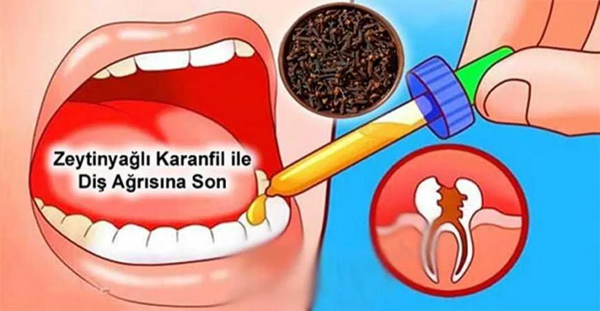 DİŞ AĞRISINA BU KÜRLE SON