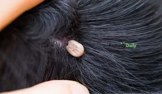 Oğlumun saçında bunu yeni keşfettim. Bu nedir?