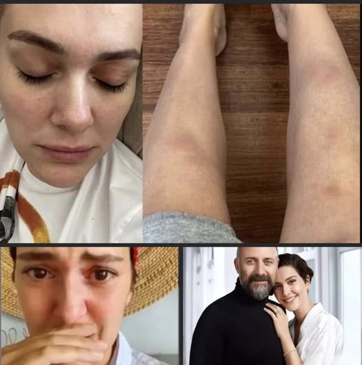 Bir süre önce Türkiye’den ayrılıp başka ülkede yaşamaya başlayan Bergüzar Korel