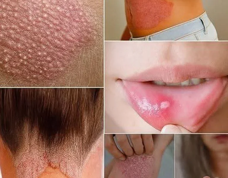 Da… adı verilen bir hastalığa sahipseniz bilmeniz gereken işaretler