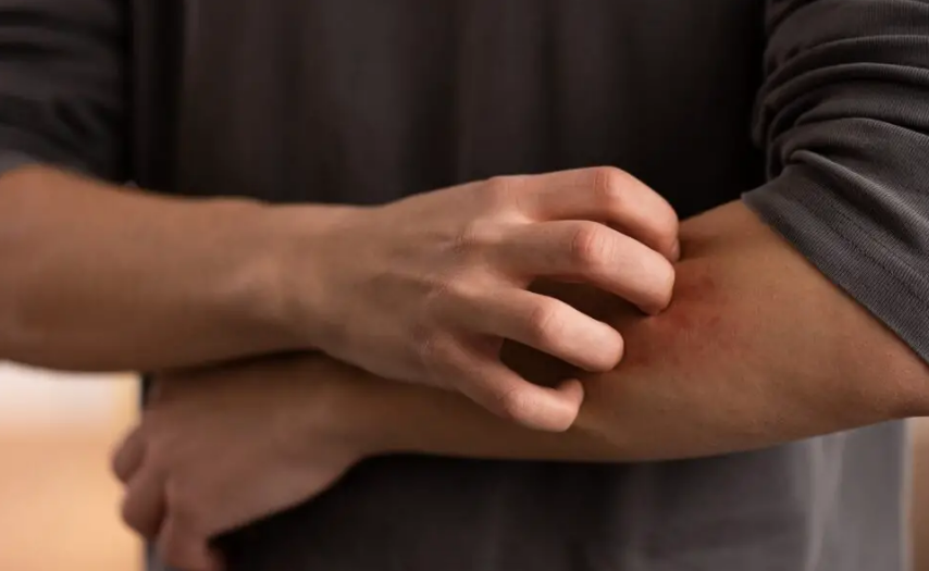 Kolunuzdaki Bu Küçük Kırmızı Noktaları Göz Ardı Etmeyin – Önemli Uyarı İşaretleri Olabilirler