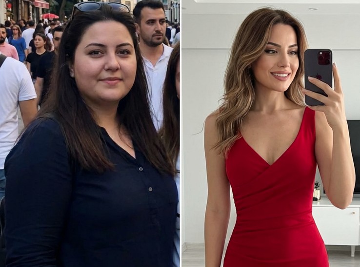 Eski sevgilim beni en yakın arkadaşım için terk etti. Ben onun “şişman kız arkadaşıydım.” Aylar sonra, düğün günlerinde annesi beni aradı ve sadece şunu söyledi: “Bunu kaçırmak istemezsin…”